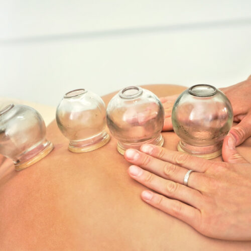 terapia con ventosas